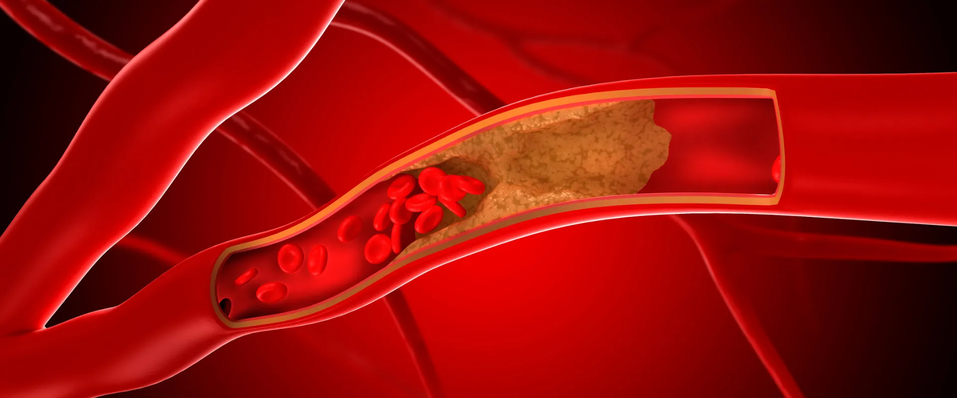 Dr. Ricardo Olguín, cirujano vascular y endovascular de INDISA: “El principal problema de las enfermedades vasculares es que se desarrollan de forma silenciosa por años”