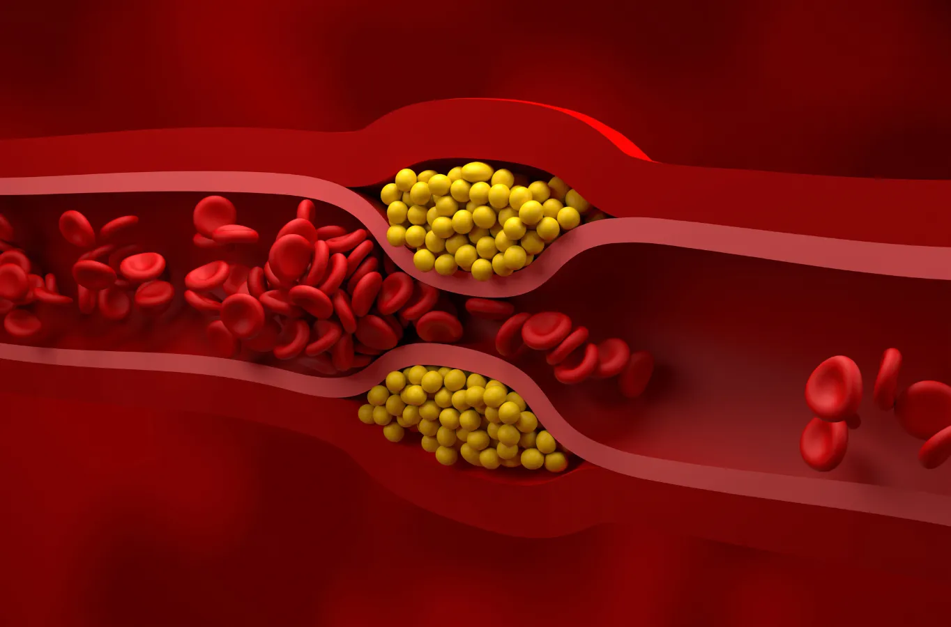 Hablemos de… Colesterol