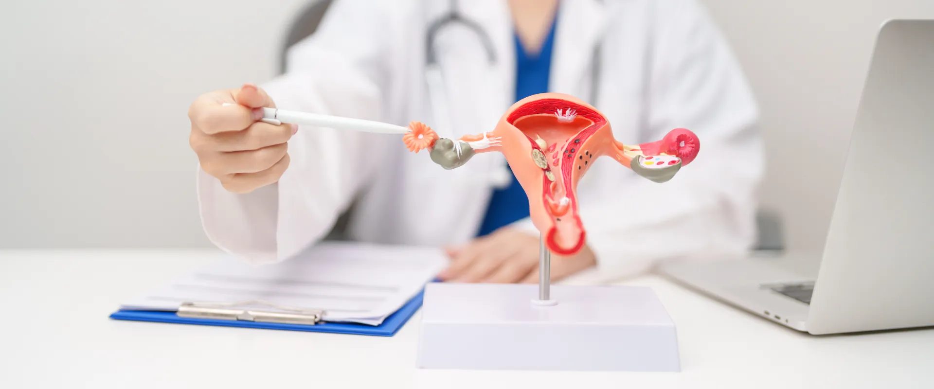 Histerectomía: mitos y realidades sobre una de las cirugías ginecológicas más frecuentes